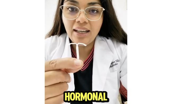 5 cosas sobre DIU hormonal